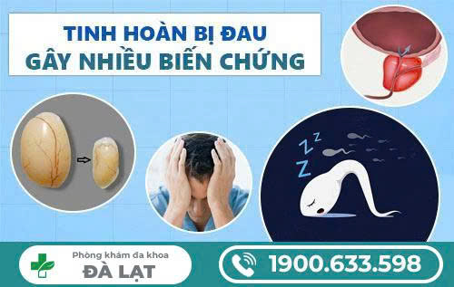 Hình ảnh minh họa